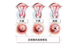 广州代生子费用零风险，试管婴儿容易做吗_囊胚是保障美国试管婴儿***的“密